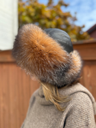 Person wearing a fur-lined hood outdoors with a wooden fence and trees in the background.